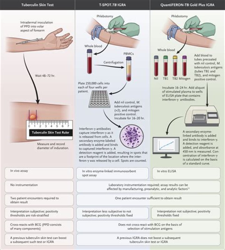 How do they test for TB in sheep?