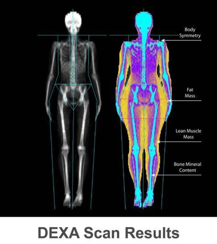 How much does a DEXA body scan cost?