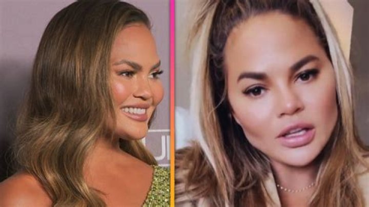 What has Chrissy Teigen done to face?