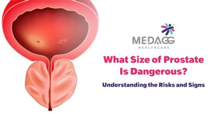 What is a good size prostate?