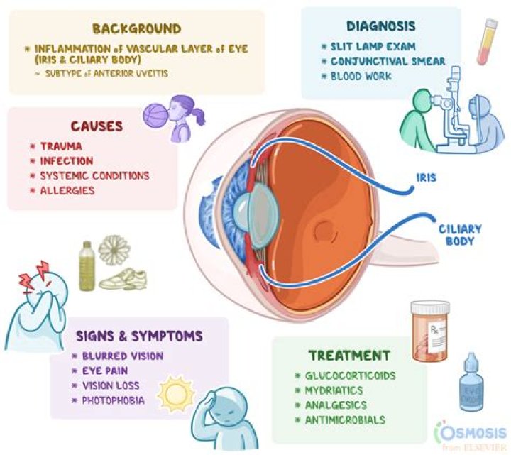 What is an iridocyclitis?
